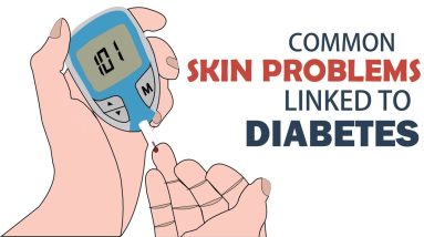 Common Skin Problems Linked to Diabetes 20 1682253571 maxresdefault