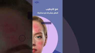 اعرفي اكترعن LaRoche Posay Lipikar Eczema Cream🤩 Voua #ڤوا #moisturizer #مرطب #لاروش #laroucheposay 8 1682253998 maxresdefault
