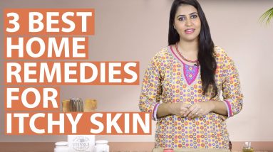 3 Best Home Remedies To Get Rid Of ITCHY SKIN ALLERGIES Naturally 16 1682260980 maxresdefault