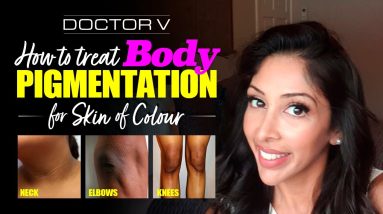 Doctor V - How To Treat Body Pigmentation For Skin Of Colour | Brown Or Black Skin | 14 1682262306 maxresdefault