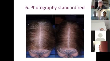 Webinar with Dr. Epstein and Dr. Epstein on the Management and Treatment of Female Hair Loss 4 1682264306 maxresdefault