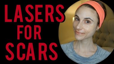 Lasers for scars| Q&A with dermatologist Dr Dray 12 1682268289 maxresdefault