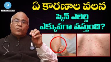 ఏ కారణాల వలన స్కిన్ ఎలెర్జి ఎక్కువగా వస్తుంది? Skin Allergy by | Itching | Telugu Popular TV 8 1682273213 maxresdefault