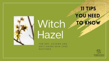 Benefits of Witch Hazel for Skin Care - For Dry, Eczema & Anti-Aging Skin 2 1682284401 maxresdefault