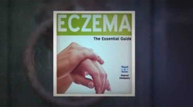 Coconut Oil Eczema : Natural Coconut Oil for Eczema Treatment! 20 1682308342 hqdefault