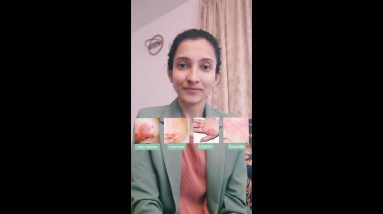 1682310713 maxresdefault