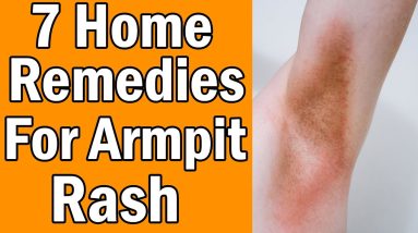 7 Home Remedies For Armpit Rash 12 1682323020 maxresdefault