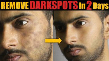 1682332872 maxresdefault