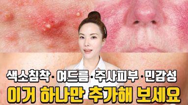 1682336959 maxresdefault