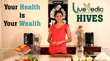 DIY: How To Cure Hives with natural home remedies - Skin Care | LIVE VEDIC 4 1682337788 maxresdefault