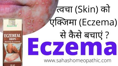 Eczema या त्वचा की ऐलर्जी के लिए अपनाए ECzeheal | पाए छुटकारा जल्द से जल्द 6 1682354115 maxresdefault