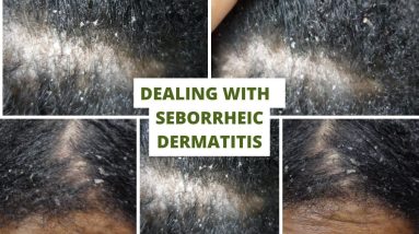 1682354920 maxresdefault