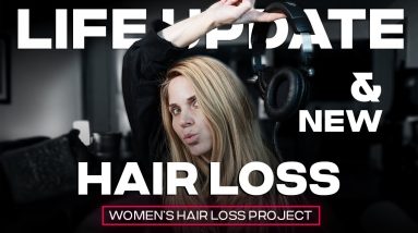 Life Update and a New Hair Loss - Diffuse Alopecia Areata (Incognita) 12 1682357254 maxresdefault