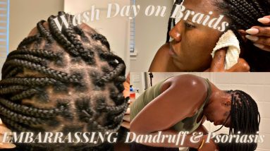 Wash Day Routine on Braids | VERY DETAILED | Scalp Issues + Dandruff and Psoriasis | 6 1682370835 maxresdefault
