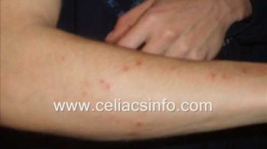 1682373320 hqdefault