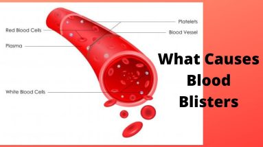 1682379023 maxresdefault