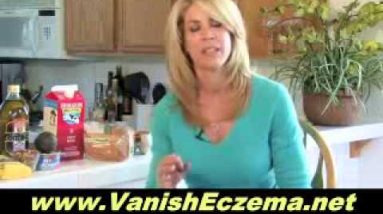 Side Effects With Using Hydrocortisone Cream As Eczema Treatment 20 1682379288 hqdefault