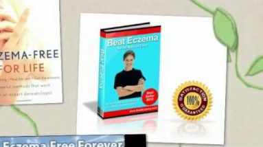 Herbal Remedies For Eczema -- The Best Herbs to Use For Treatment 10 1682383580 hqdefault
