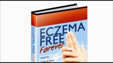 Facial Eczema - Skin Care Tips To Put Your Best Face Forward and Rid yourself of Facial Eczema 8 1682409325 hqdefault