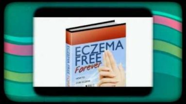 Handling Eczema During Pregnancy 6 1682412983 hqdefault
