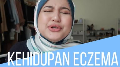 MY ECZEMA STORY 8 1682419726 maxresdefault