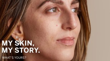 How to get rid of eczema? 6 1682423410 maxresdefault