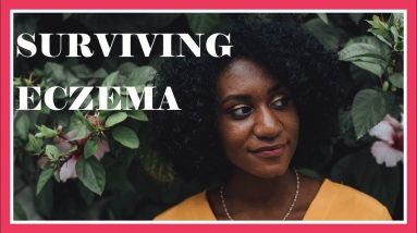 How to Survive Eczema on Your Wedding Day 4 1682425876 maxresdefault