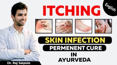 Why & How Ayurveda Cures Skin Infections | How to Get Rid of Any Skin Infections | Dr Raj Satpute 4 1682462739 maxresdefault