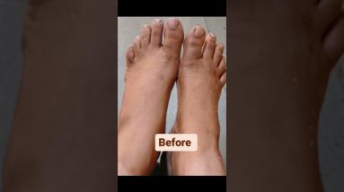 5 Rupee me Ghar par padicure kare # padicure at home #shortsvideo 18 1682474978 maxresdefault