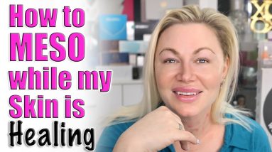 How to MESO While your Skin is Healing | Code Jessica10 saves you Money at All Approved Vendors 6 1682497174 maxresdefault
