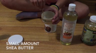 Homemade All Natural Eczema Cream 4 1682537839 maxresdefault
