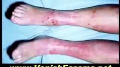 1682635468 hqdefault