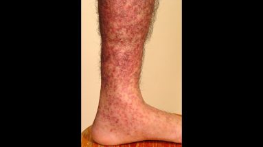 1682639143 maxresdefault