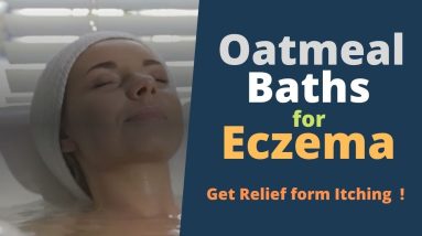 Oatmeal Baths for Eczema - Use Colloidal Oatmeal, It is Good for Eczema 16 1682671054 maxresdefault