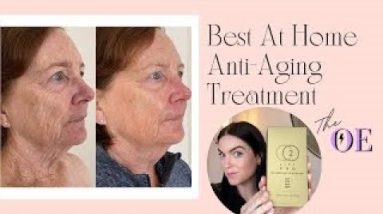 Best At Home Anti-Aging Treatment | CO2 Lift Pro Carboxy Therapy Mask 8 1682721035 hqdefault