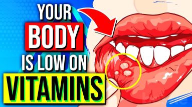 THESE 8 Warning Signs REVEAL Your Body Is LOW On Essential Vitamins! ⚠️ 14 1682735546 maxresdefault