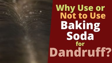 Baking Soda for Dandruff - Would it Get Rid of Dandruff or Not? 10 1682761475 maxresdefault