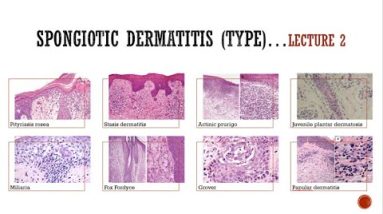 1682777318 hqdefault