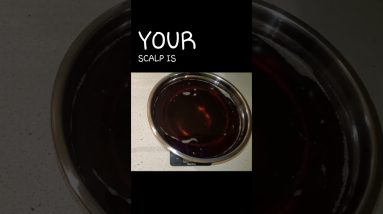 Reminder for Dry Scalp | Nfinite Coils 2 1682787198 maxresdefault
