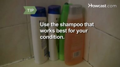 How to Get Rid of Dandruff 16 1682794328 maxresdefault