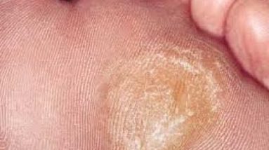 1682806593 hqdefault