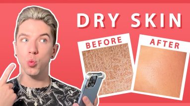 The Ultimate Q&A for Dry Skin 18 1682889327 maxresdefault