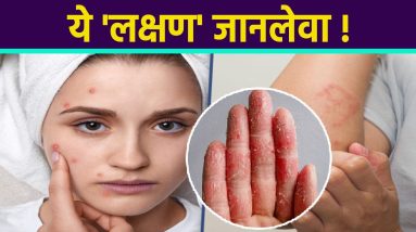 1682904225 maxresdefault