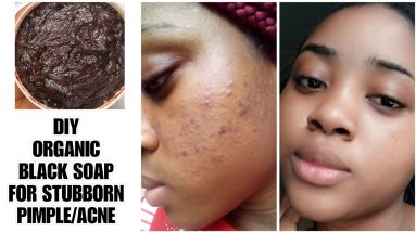 DIY ORGANIC BLACK SOAP FOR STUBBORN PIMPLE /MG ORGANICS/#pimple #blacksoap #glowskin #perfectface 4 1682909792 maxresdefault