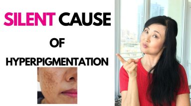 STUBBORN Hyperpigmentation is NOT Going Away 20 1682969076 maxresdefault