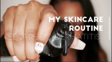 How to cure Seborrheic Dermatitis | Imani Elle 14 1682980059 maxresdefault