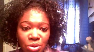 Seborrheic Dermatitis- Do you have it.wmv 8 1683020708 hqdefault