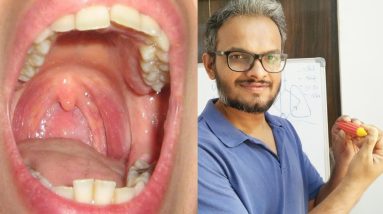 1683150725 maxresdefault