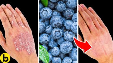 What You Should Eat If You Have Psoriatic Arthritis 12 1683379123 maxresdefault