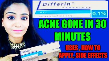 DIFFERIN GEL | DIFFERIN GEL INDIA | DIFFERIN GEL PRICE | DIFFERIN GEL REVIEW | HEENA 8 1683386442 maxresdefault